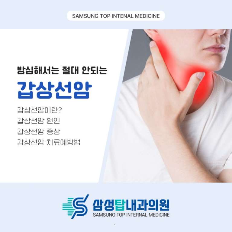 갑상선암 증상을 묘사하는 인포그래픽