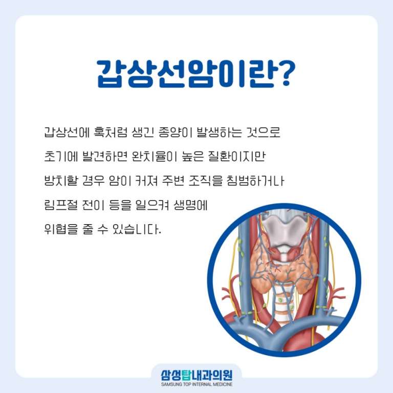 갑상선암에 대한 설명