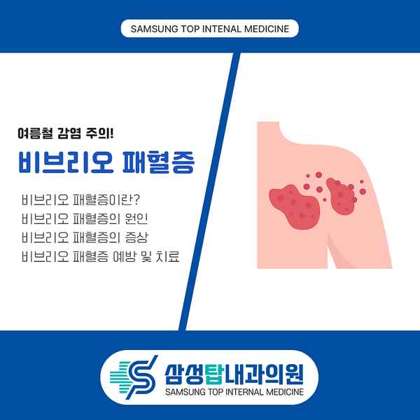 온도가 높은 날에 더욱 주의해야 하는 비브리오 패혈증, 증상 및 예방법