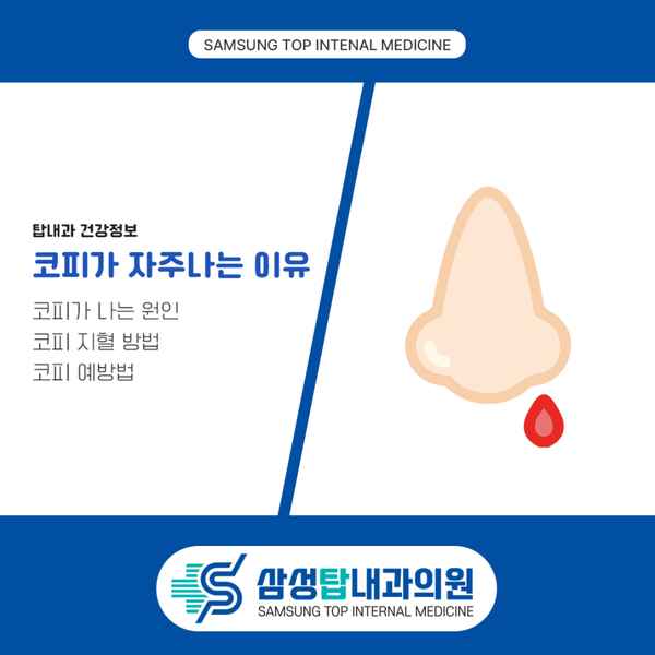 코피가 자주나는 이유, 원인과 지혈 방법 알려드립니다