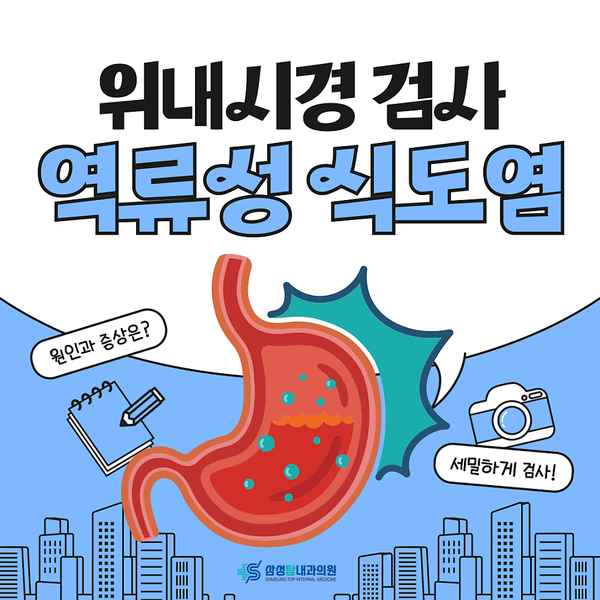역류성 식도염 원인과 증상, 위내시경으로 세밀하게 검사해 보자