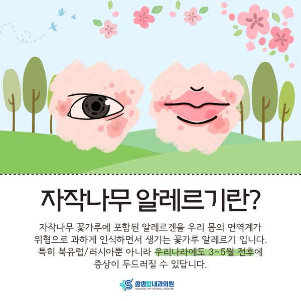 자작나무 꽃가루 알레르기 원인 안내